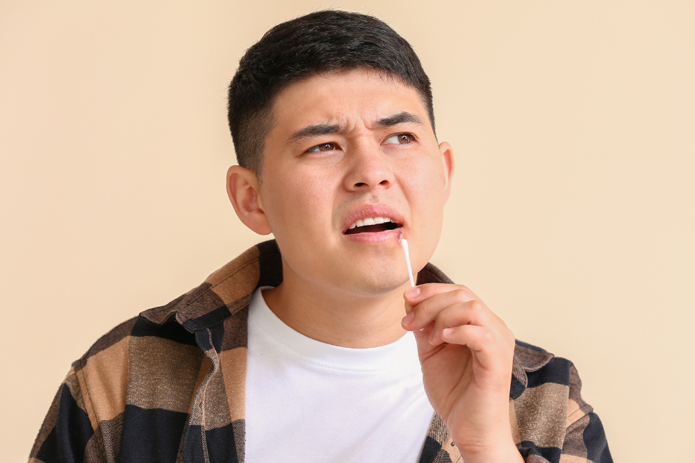 Man with cold sore swab.