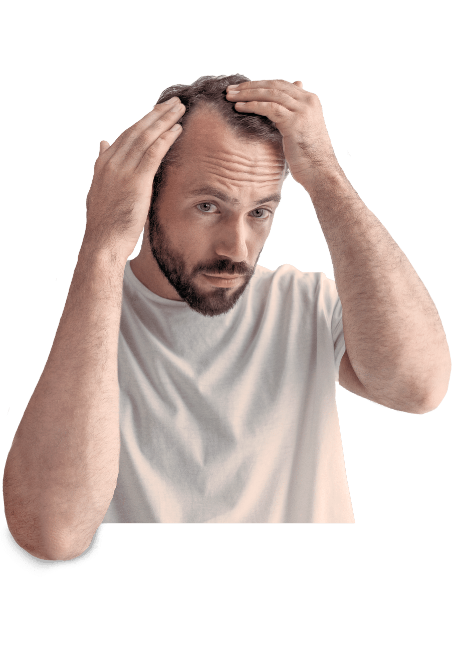 hairLoss