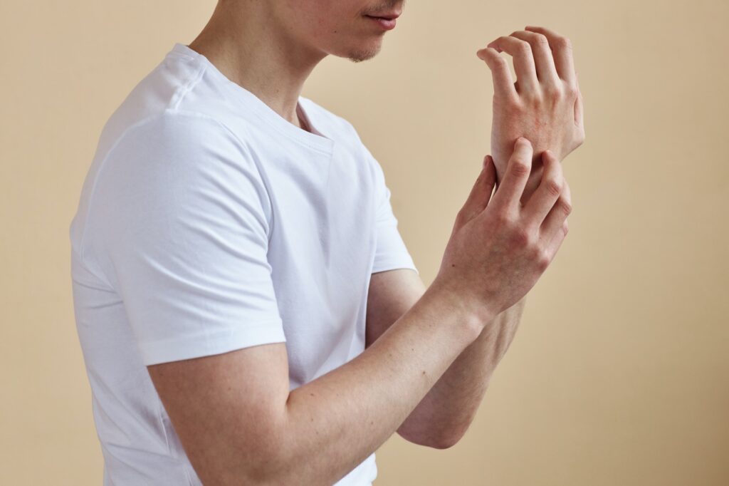 Unrecognizable man scratching hands allergies and psoriasis
