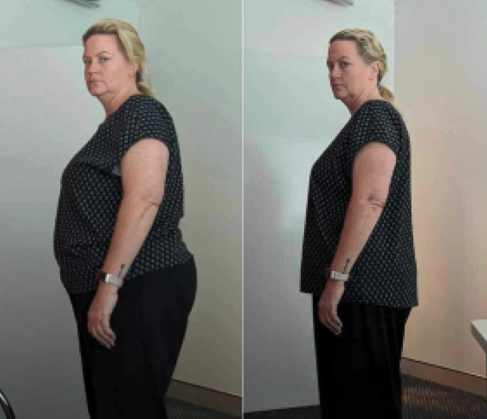 before and after results from weight loss